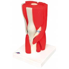 8-Part Elbow Joint Anatomy Model With Removable Muscles - Life-Size For Study & Display