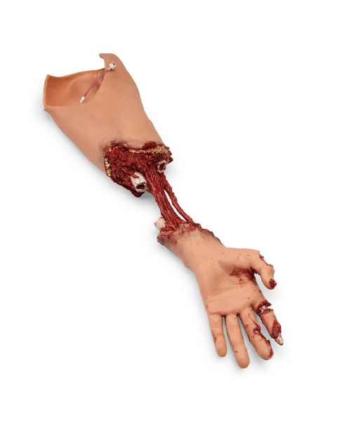 Simulaids Xtreme Trauma Bleeding Arm for Advanced SMART STAT
