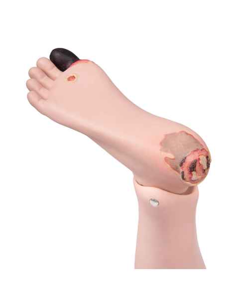 Lower Leg Right Diabetes