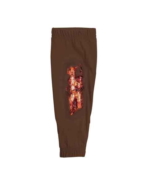 STOPS Medical 1025978 Radial/Ulna Open Fracture Sleeve - Dark Skin Tone
