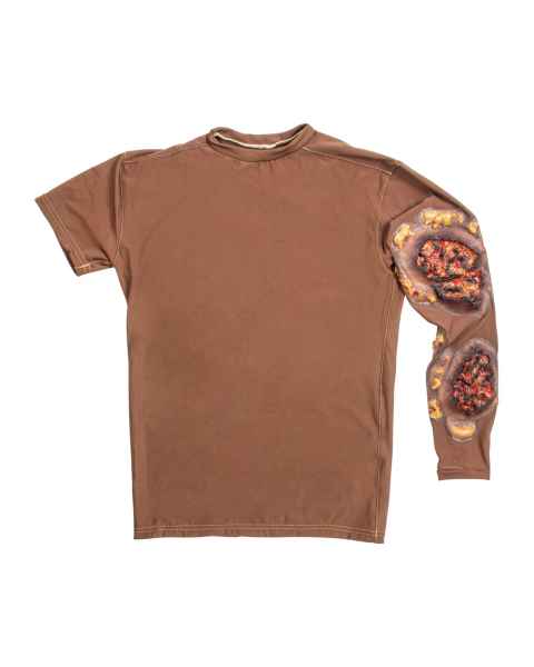STOPS Medical 1025983 Full Thickness Arm Burn Long Sleeve Shirt, Dark Skin Tone - Front
