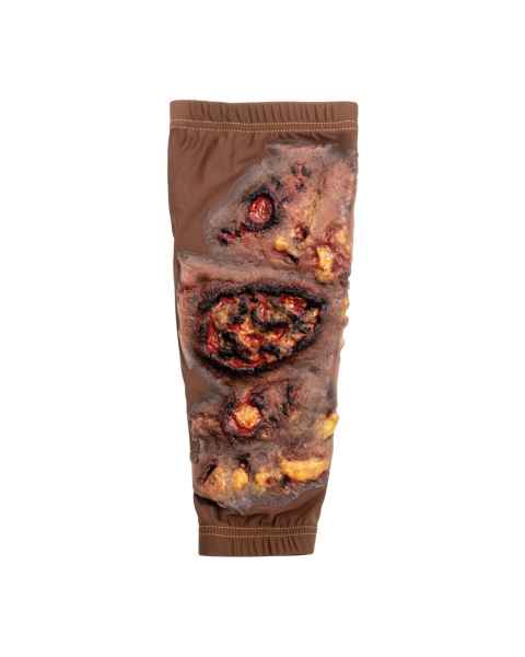 STOPS Medical 1025984 Full Thickness Lower Leg Burn Lower Leg Sleeve - Dark Skin Tone