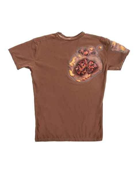 STOPS Medical 1025985 Full Thickness Chest and Back Burn Short Sleeve Shirt, Dark Skin Tone - Front