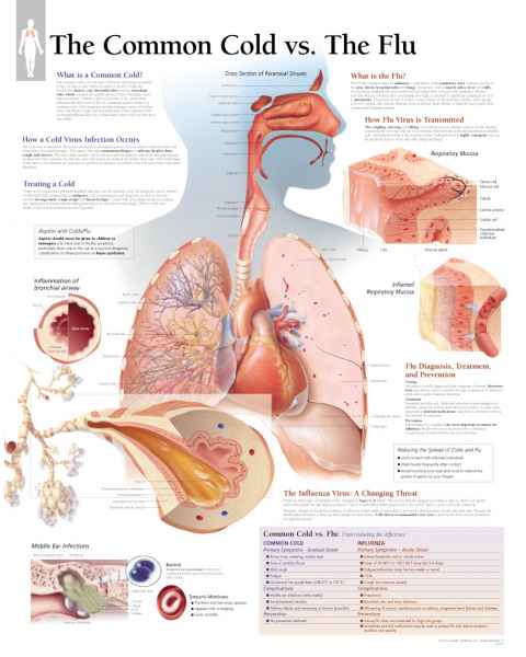 The Common Cold vs. The Flu Chart