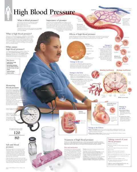 High Blood Pressure Chart