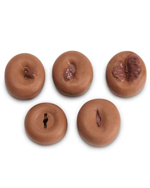 Cervix Set - Set of 5