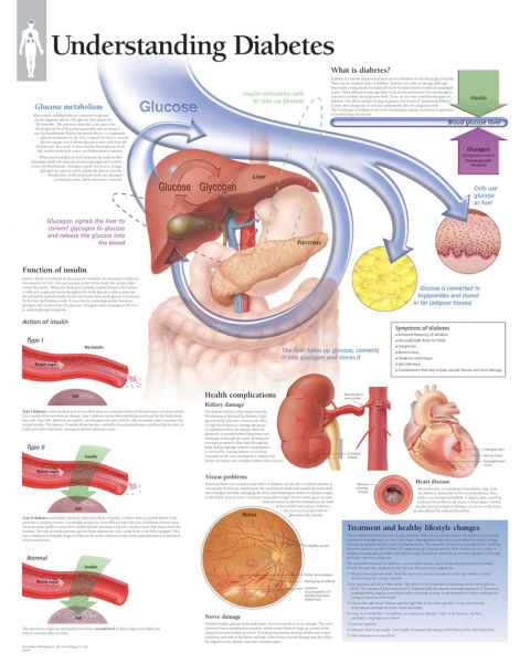 Understanding Diabetes Chart