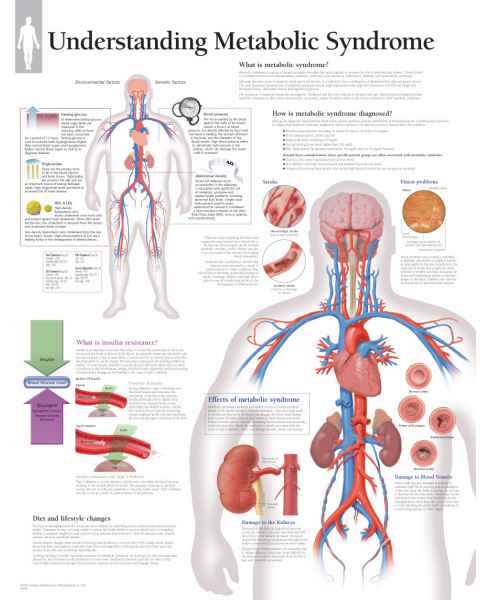 Understanding Metabolic Syndrome Chart