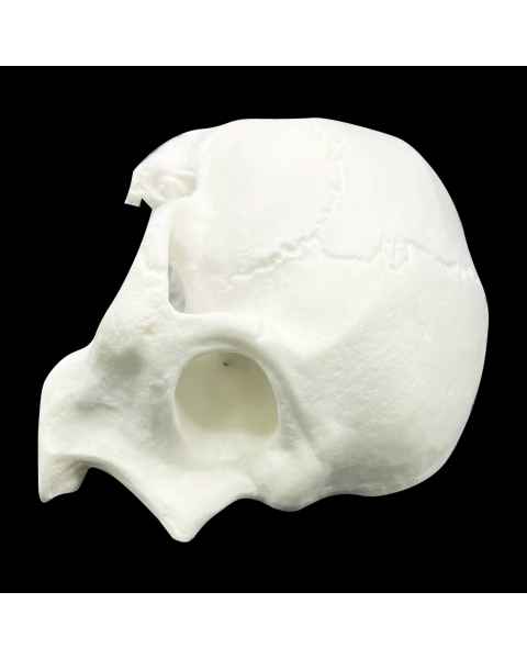 Bone Models&trade; 200800 Half Skull Surgical Practice Model, Front View