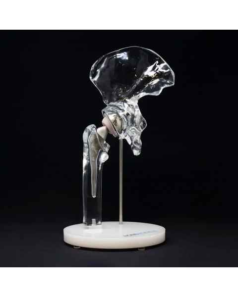 Bone Models&trade; 390200 Clear Hip Display Model with Generic Implant
