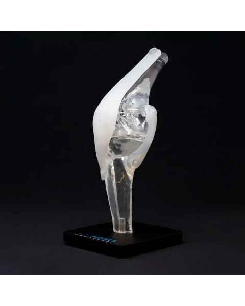 Bone Models&trade; 390300 Clear Anatomical Knee Display Model