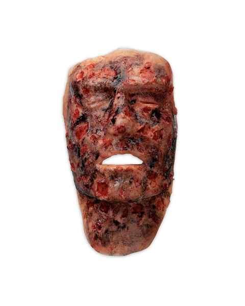 Life/form Moulage Wound - 3rd Degree Face Burn Simulator