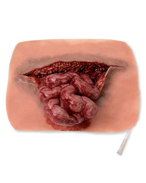 Life/form Moulage Wound - Eviscerated Intestine Simulator