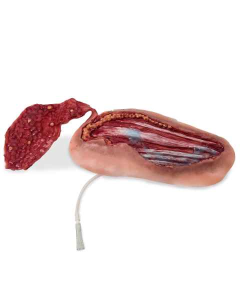Life/form Moulage Wound - Forearm with Skin Flap Avulsion Simulator