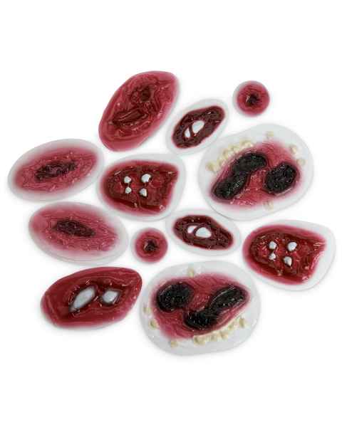 Life/form Moulage Fractures & Lacerations - Set of 12