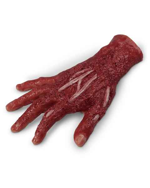 Life/form Moulage Wound - Chemical Burn, 4th Degree, Right Hand Simulator