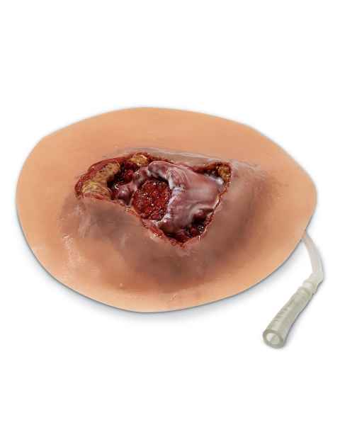 Life/form Moulage Wound - Fractured Humerus Simulator