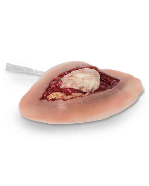 Life/form Moulage Wound - Open Ankle Dislocation Simulator