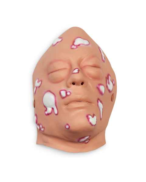 Life/form Moulage Wound - Mustard Gas, Face Simulator