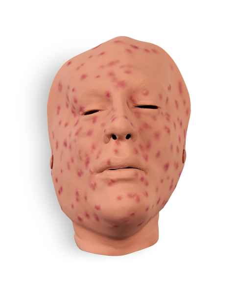 Life/form Moulage Wound - Smallpox, 2nd Day, Face Simulator
