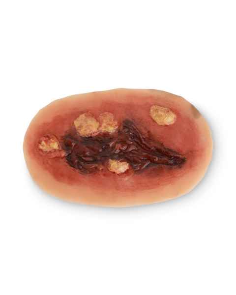 Life/form Moulage Wound - 2nd Degree Burn Simulator