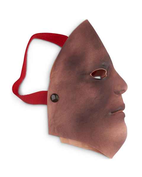 Life/form Moulage Wound - Burn - Face - 2nd/3rd Degree Simulator