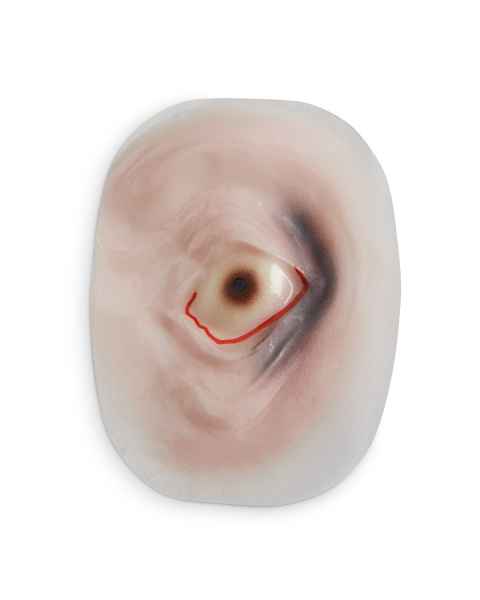 Life/form Moulage Wound -  Ecchymosis Wound Simulator