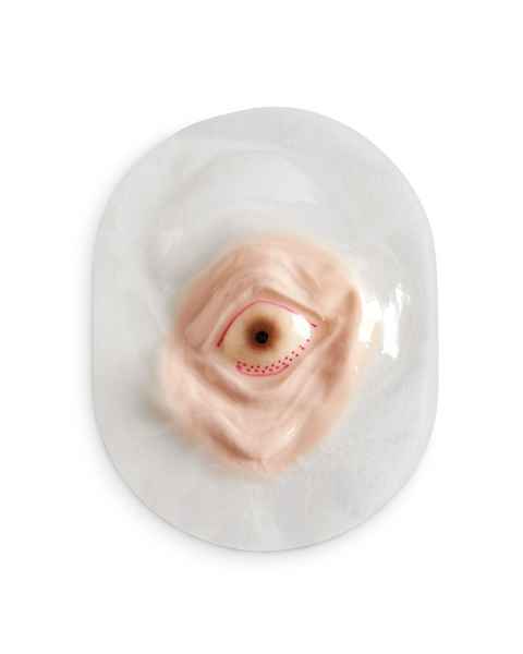 Life/form Moulage Wound - Petechiae Wound Simulator