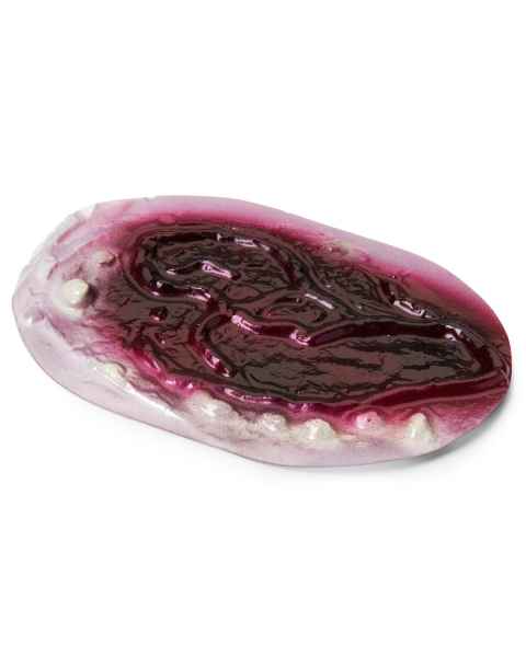 Life/form Moulage Wound - Burns - 1st, 2nd, & 3rd Degree Wound Simulator