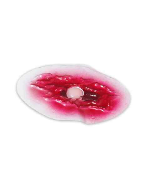 Life/form Moulage Wound - Bladder Wound Simulator