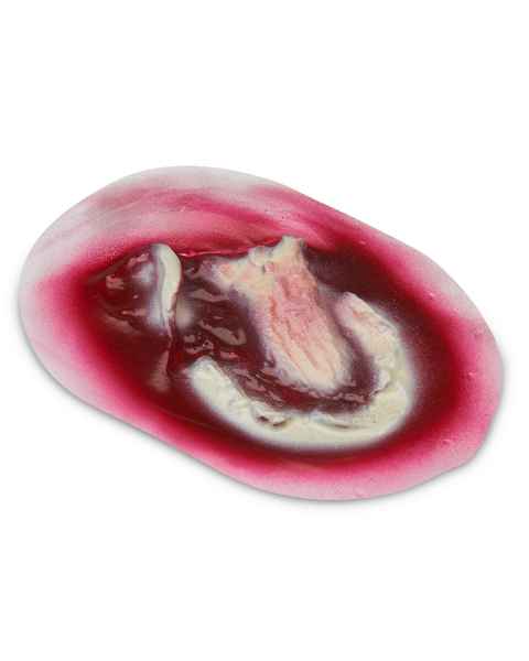 Life/form Moulage Wound - Avulsion - Stick-On - Major - 8 x 5 cm Wound Simulator