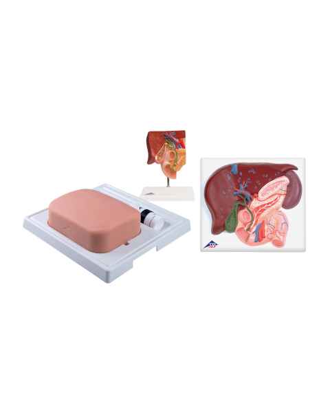 3B Scientific 8000884 Gallbladder Set
