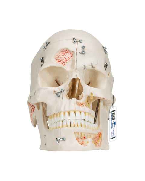 3B Scientific A27 Deluxe Human Demonstration Skull (10-Part)