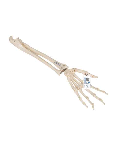 3B Scientific A40/3 Loose Hand Skeleton with Portions of Ulna and Radius