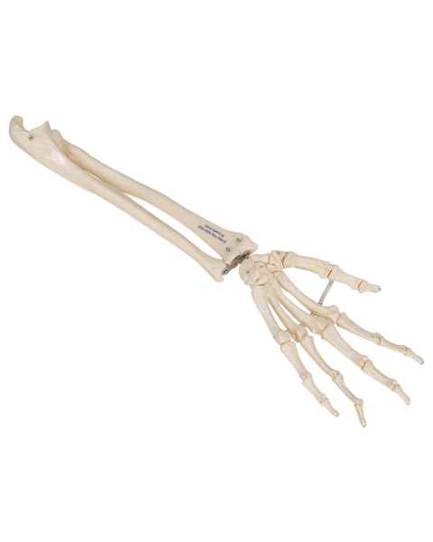 3B Scientific A40-3 Human Hand Skeleton Model with Ulna Radius Elastic Mounted String 3B Smart Anatomy