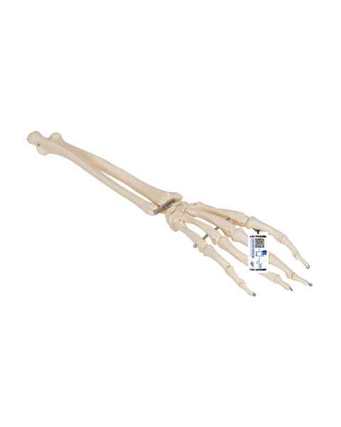 3B Scientific A41 Hand Skeleton With Portions of Ulna and Radius, Wire Mounted
