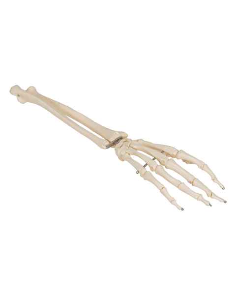 3B Scientific A41 Human Hand Skeleton With Portions of Ulna and Radius Wire Mounted - 3B Smart Anatomy