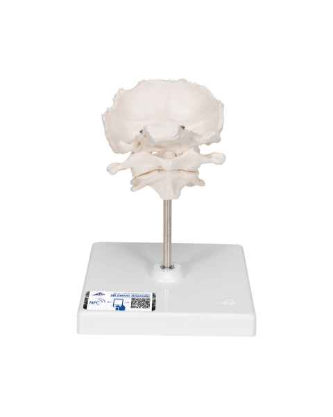 3B Scientific A75-1 Atlas and Axis with Occipital Plate on Stand - 3B Smart Anatomy