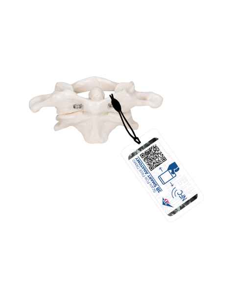 3B Scientific A71 Atlas and Axis (Without Stand) - 3B Smart Anatomy