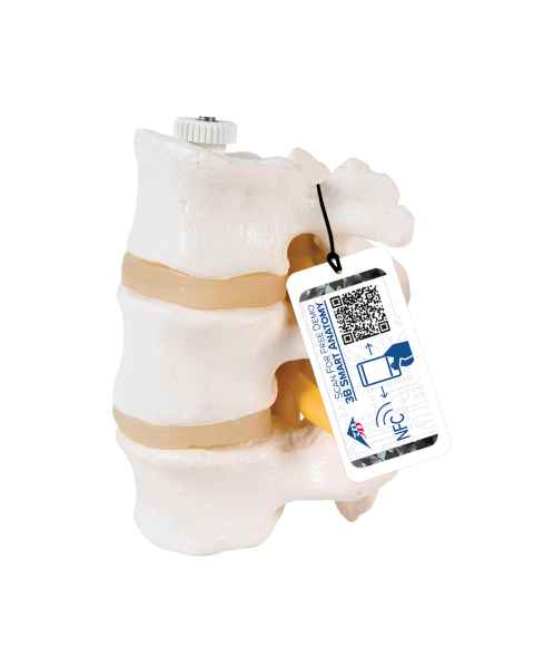 3B Scientific A76/8 Three Lumbar Vertebrae Flexibly Mounted - 3B Smart Anatomy