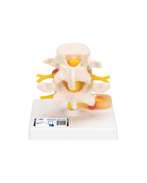 3B Scientific A76 Lumbar Vertebrae Teaching Model - 3B Smart Anatomy