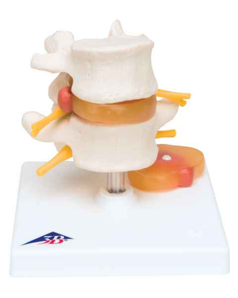 Lumbar Vertebrae Teaching Model