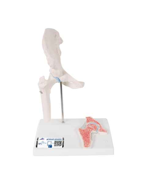 3B Scientific A84-1 Mini Hip Joint with Cross Section of Bone - 3B Smart Anatomy
