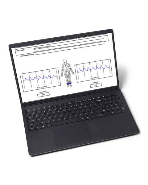 Newman Medical ABI-120 Newman Medical Windows Computer for simpleABI System