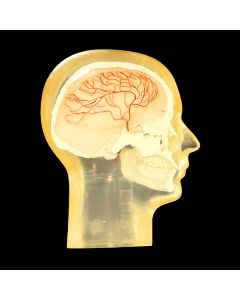 RSD RS-245T Half Angiographic Head Phantom with Step Wedge & Resolution Test Pattern (2-10 lp/mm)
