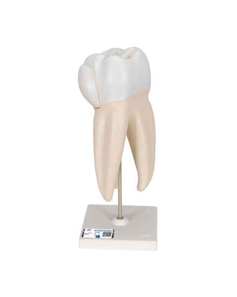 Upper Triple-Root Molar 3-Part