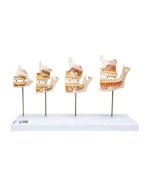 3B Scientific D20 Dentition Development - 3B Smart Anatomy