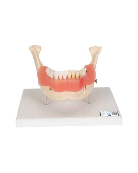 Diseases of the Teeth 21-Part