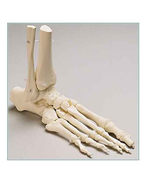 Premier Elastic-Mounted Foot with Distal Tibia & Fibula