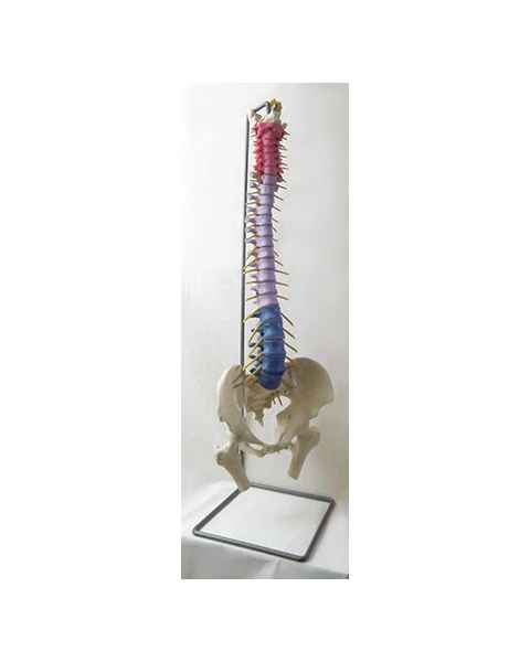 Color-Coded Premier Flexible Spine with Disc Prolapse & Femur Heads